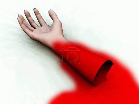 Téléchargez les photos : Bras sanglant sur fond blanc - en image libre de droit