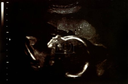 Foto de Ultrasonido embarazo exploración de cerca - Imagen libre de derechos