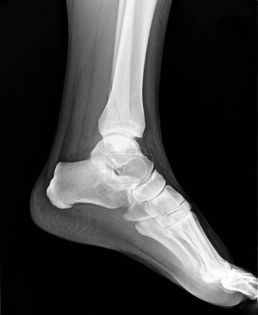 Photo for Left foot MRI with toes - X-ray - Royalty Free Image