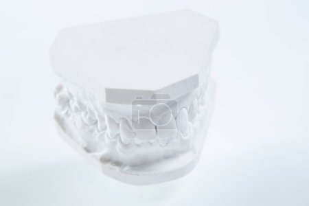 Photo for "Gypsum model of human jaw on a white background." - Royalty Free Image