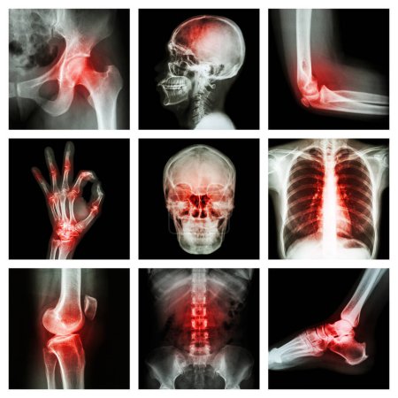 Photo for Collection X-ray and multiple injury - Royalty Free Image