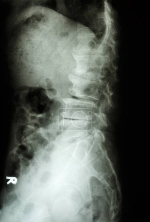 Foto de X - rayos del cuerpo humano - Imagen libre de derechos