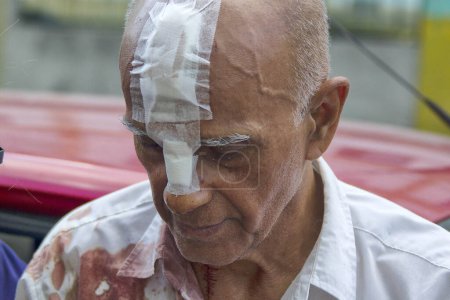 Téléchargez les photos : BRÉSIL, Rio de Janeiro : Un homme marche avec des bandages sur la tête après avoir été blessé dans l'explosion d'un bâtiment à Rio de Janeiro, au Brésil, le 5 avril 2016.. - en image libre de droit