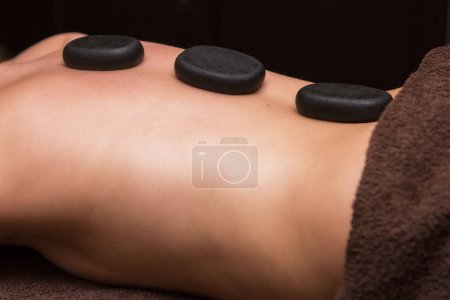 Téléchargez les photos : Thérapie avec des pierres chaudes dans le centre spa - en image libre de droit