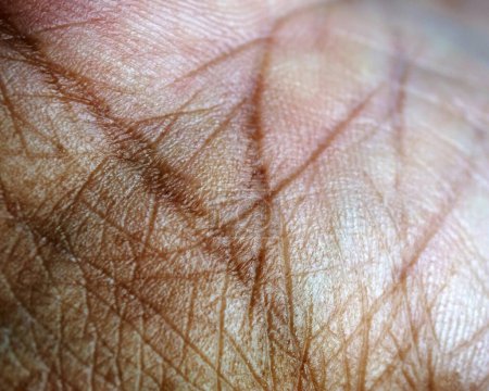 Photo for Human skin texture close up - Royalty Free Image
