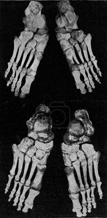 Téléchargez les photos : Squelette du pied droit et du pied gauche de l'homme, gravure vintage - en image libre de droit