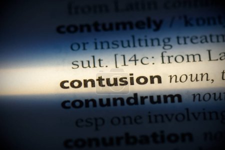 Photo for Contusion word, highlighted in dictionary, close up view - Royalty Free Image
