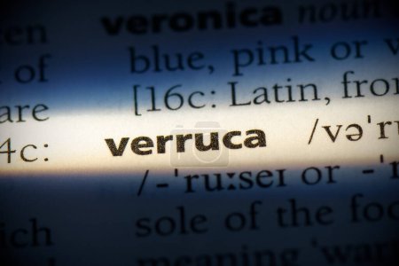 Foto de Verruca palabra, resaltado en el diccionario, vista de cerca - Imagen libre de derechos