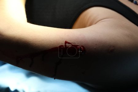 Téléchargez les photos : Sang sur un corps de femme - en image libre de droit
