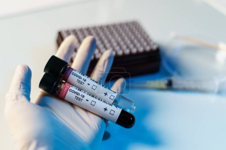 Téléchargez les photos : "Processus de test du coronavirus, une main tient un tube de test sanguin - en image libre de droit