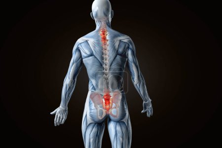 Foto de Visión anatómica dolor de espalda. Ilustración 3D. - Imagen libre de derechos