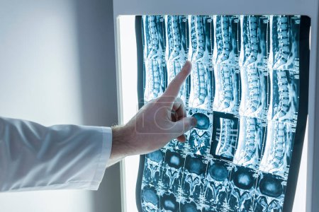 Foto de Neurólogo y cirujano examinan imagen de la columna vertebral de un paciente - Imagen libre de derechos