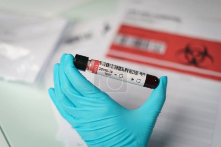 Photo for "Coronavirus testing, a hand holds tube of blood test samples - Royalty Free Image
