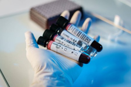 Photo for "Coronavirus testing process, a hand holds tube of blood test samples - Royalty Free Image