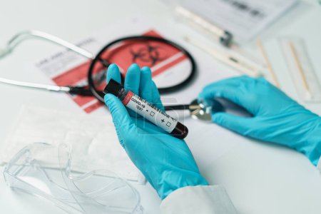 Téléchargez les photos : "Test de coronavirus, une main tient un tube d'échantillon de test sanguin - en image libre de droit