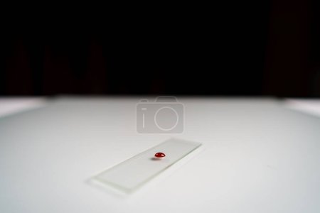 Téléchargez les photos : Sang humain au microscope à lames en laboratoire. - en image libre de droit
