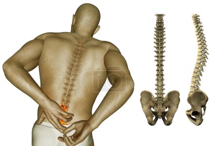 Téléchargez les photos : Illustration numérique douleur dans le dos et la colonne vertébrale - en image libre de droit