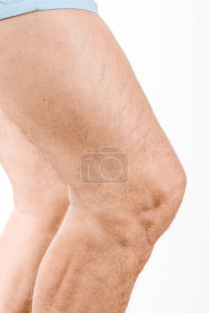 Foto de Primer plano de la rodilla del hombre sobre fondo blanco - Imagen libre de derechos