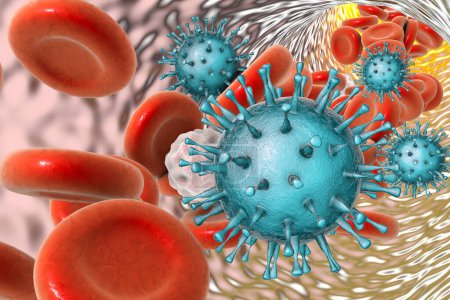 Téléchargez les photos : Cytomégalovirus dans le sang, illustration - en image libre de droit