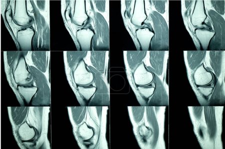 Foto de Resonancia magnética de un paciente radiografía de rodilla - Imagen libre de derechos