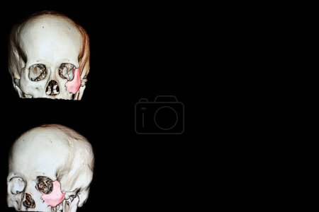 Téléchargez les photos : Crânes sur fond noir, illustration colorée - en image libre de droit