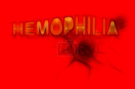 Photo for Hemophiliaand blood cell ,health concept on background - Royalty Free Image