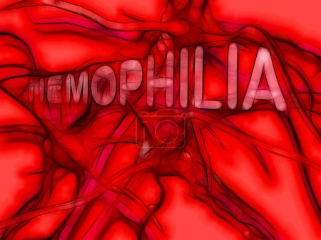 Photo for Red hemophilia, 3d illustration - Royalty Free Image