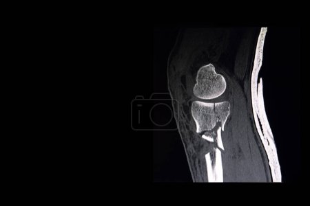 Photo for CT scan of knee - Royalty Free Image