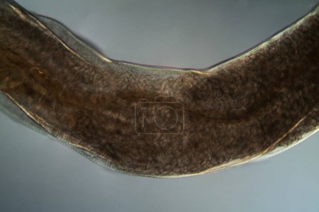 Téléchargez les photos : Oxiuris ver parasite 100x sous la microskope - en image libre de droit
