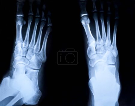 Foto de Pie humano tobillo y pierna imagen de rayos X - Imagen libre de derechos