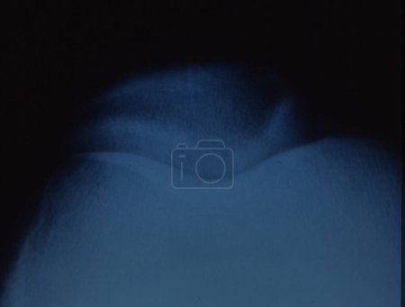 Téléchargez les photos : Image radiographique de la rotule avec articulation - en image libre de droit