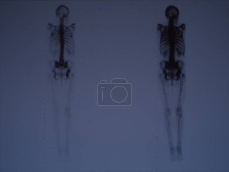 Photo for Whole body x-ray image for medical diagnosis - Royalty Free Image