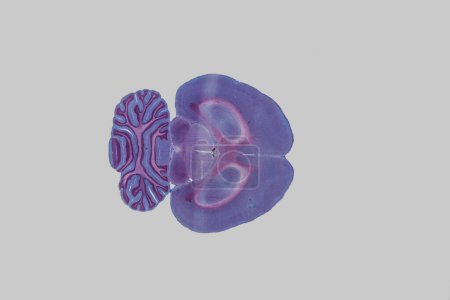 Foto de Cerebro púrpura sobre fondo blanco - Imagen libre de derechos