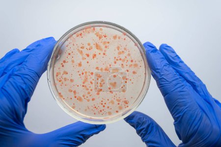 Téléchargez les photos : Deux mains gantées d'un scientifique tenant une boîte de Pétri avec des bactéries rouges. - en image libre de droit