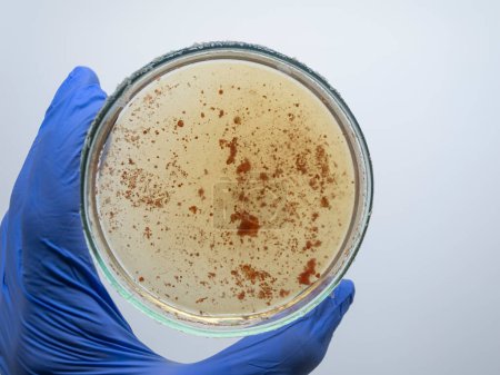 Téléchargez les photos : Bactéries rouges gros plan - en image libre de droit