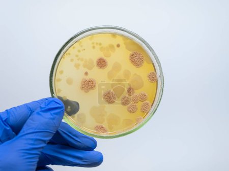 Photo for "Hand holding a Petri dish with colonies" - Royalty Free Image