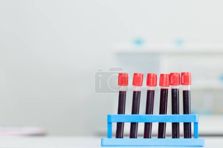 Photo for Blood tubes in laboratory - Royalty Free Image