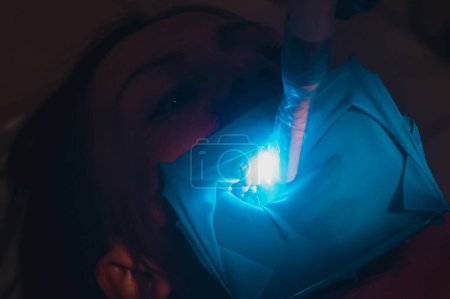 Photo for "Ultraviolet light in dentistry, treatment of upper masticatory teeth." - Royalty Free Image