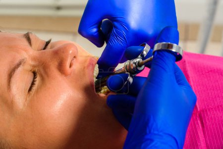 Photo for "Local anesthesia, the dentist uses a carpal syringe, introducing local anesthesia into the gums." - Royalty Free Image
