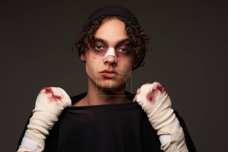 Foto de Boxeador masculino con moretones bajo los ojos entrenando la agresión de la sangre - Imagen libre de derechos