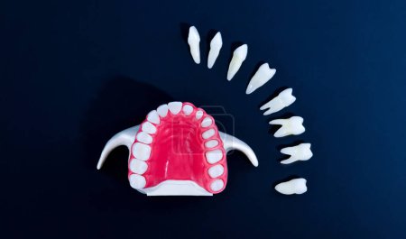 Foto de Proceso de instalación de implantes dentales y corona - Imagen libre de derechos