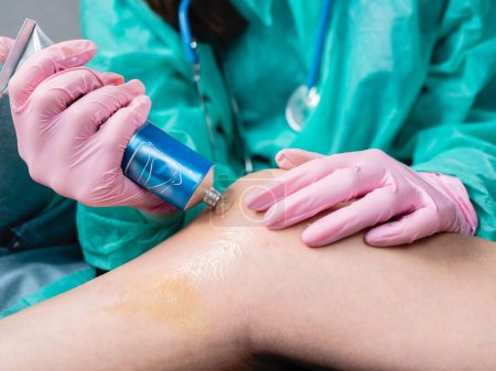 Photo for A doctor in medical gloves applies an anesthetic cream to a hematoma of a patient's knee in a clinic - Royalty Free Image