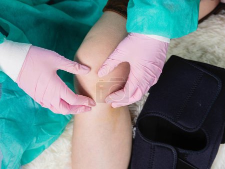 Foto de Un traumatólogo que usa guantes médicos palpa la rodilla lesionada durante un examen rutinario del paciente. - Imagen libre de derechos