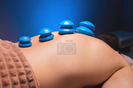Photo for "Cupping massage in general. Vacuum rubber cups for back massage for a man. Massage with vacuum cups. Cupping treatments for back pain relief. A white male lies face down" - Royalty Free Image