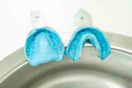 Foto de Impresión dental moldes vista de fondo - Imagen libre de derechos
