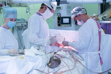 Téléchargez les photos : "Surgical operating room in a hospital with doctors who perform surgery on a man." - en image libre de droit