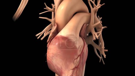 Foto de "La cirugía de revascularización coronaria se realiza utilizando un vaso sanguíneo sano llamado injerto.." - Imagen libre de derechos