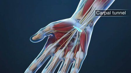 Photo for "Tendon and nerve in the hand" - Royalty Free Image