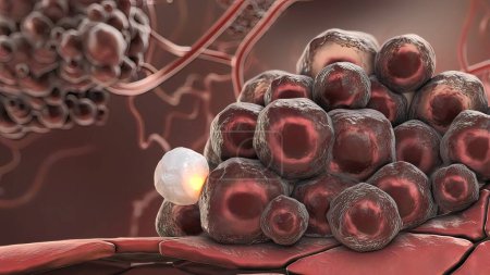 Téléchargez les photos : "Illustration 3D Cellules cancéreuses activées, tumeurs en croissance" - en image libre de droit