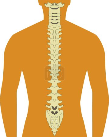 Ilustración de Columna vertebral, ilustración vectorial gráfica - Imagen libre de derechos
